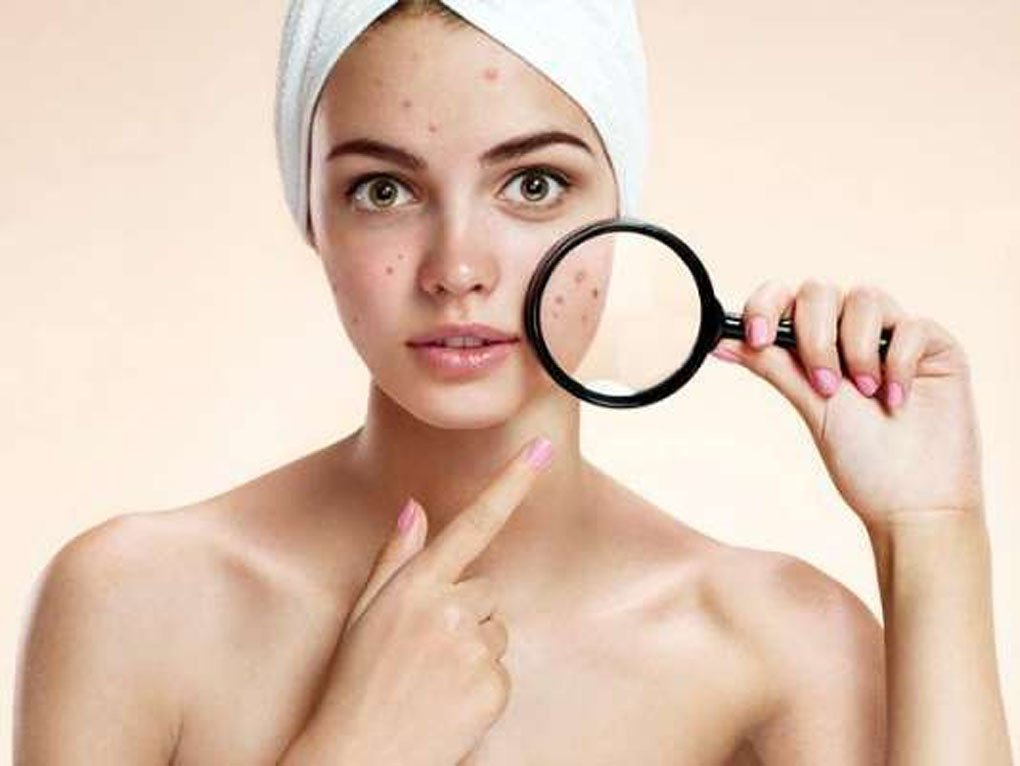 Դիմակներ տնային պայմաններում ակնեի բուժման համար